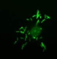 Yersinia pseudotuberculosis in the group Antibodies Other Species / Bacteria at Agrisera AB (Antibodies for research) (AS05 057)